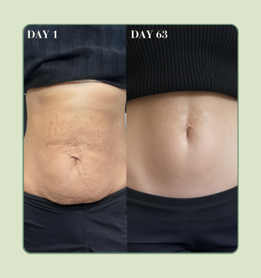Stomach Firming Cream